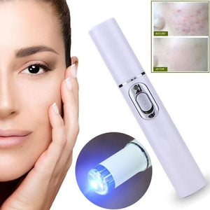 LIGHT THERAPY ACNE LASER PEN (60% OFF TODAY!)